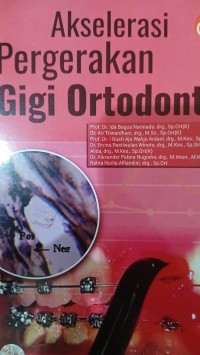 Image of Akselerasi Pergerakan Gigi Ortodonti