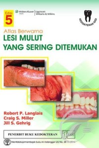 Image of Atlas Berwarna Lesi Mulut Yang Sering Ditemukan