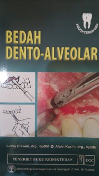 Image of Bedah Dento-Alveolar