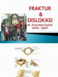 Image of Fraktur dan dislokasi