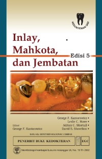 Image of Inlay, Mahkota, dan Jembatan