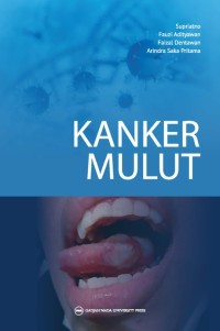 Image of Kanker Mulut