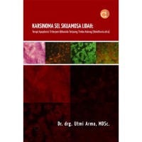Image of Karsinoma sel skuamosa lidah