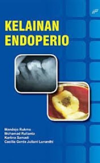 Image of Kelainan Endoperio