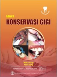 Image of Konservasi Gigi