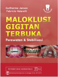 Image of Maloklusi Gigitan Terbuka : Perawatan dan Stabilisasi