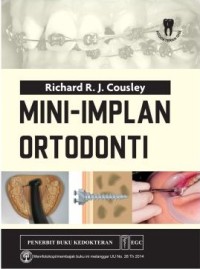 Image of Mini - Implan Ortodonti
