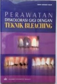 Image of Perawatan Diskolorasi Gigi dengan Teknik Bleaching