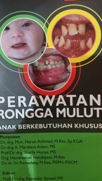 Image of Perawatan Rongga Mulut : Anak Berkebutuhan Khusus