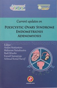 Image of Polycystic Ovary Syndrome Endometriosis Adenomyosis