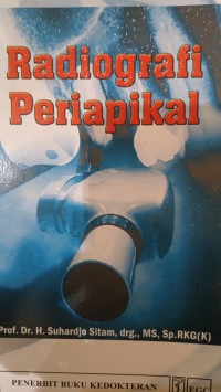 Image of Radiologi Periapikal
