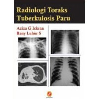 Image of Radiologi Toraks Tuberkolosis Paru